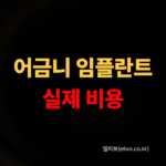 어금니 임플란트 비용｜부위별 가격 차이 실제 계산 (2026)